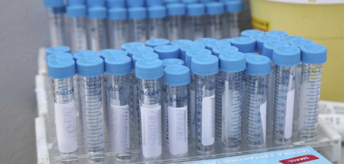 Κορονοϊός: Ανησυχεί η νέα μετάλλαξη Mu – Ενδείξεις ανθεκτικότητας απέναντι στα εμβόλια
